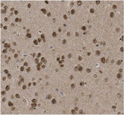 MilliporeSigma Rabbit anti-COUP-TF2, Polyclonal, 100&mu;L:Antibodies, Polyclonal